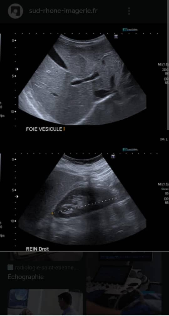 Image pour Échographie